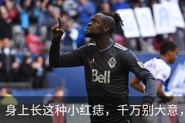 身上长这种小红痣，千万别大意，是大病来临的征兆？告诉你真相